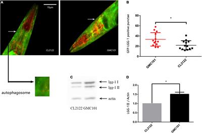 Autophagy Regulation Influences β-Amyloid Toxicity in Transgenic Caenorhabditis elegans